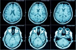 Die CT-Scan- oder MRT-Technik, die einen nicht-invasiven Blick auf das Innere des Körpers ermöglicht, wurde 1977 vom britischen Physiker Peter Mansfield entwickelt. © iztverichka, Adobe Stock